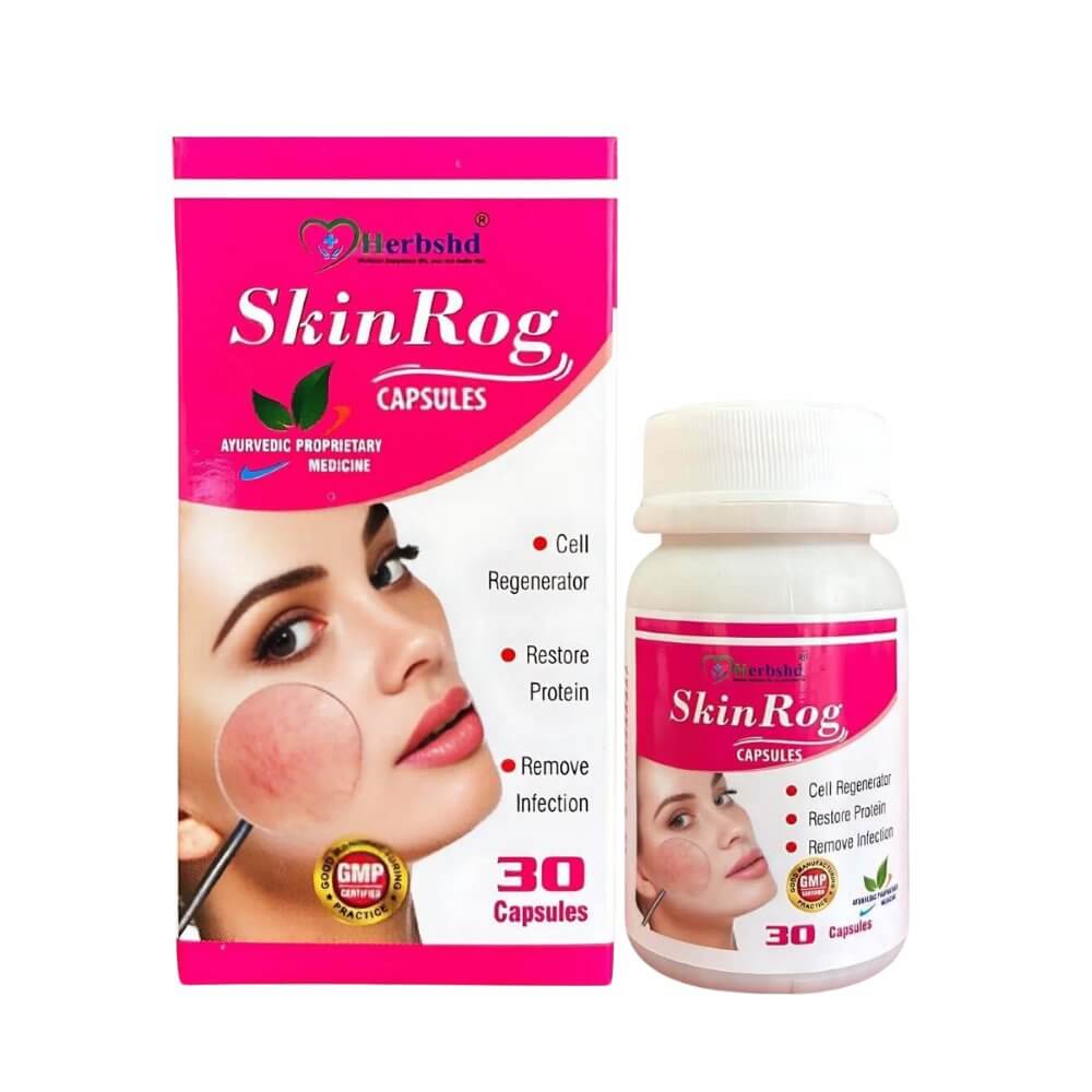 Ayurvedic Skinrog Capsule for Healthy Skin - HEALTH AIM PHARMACY