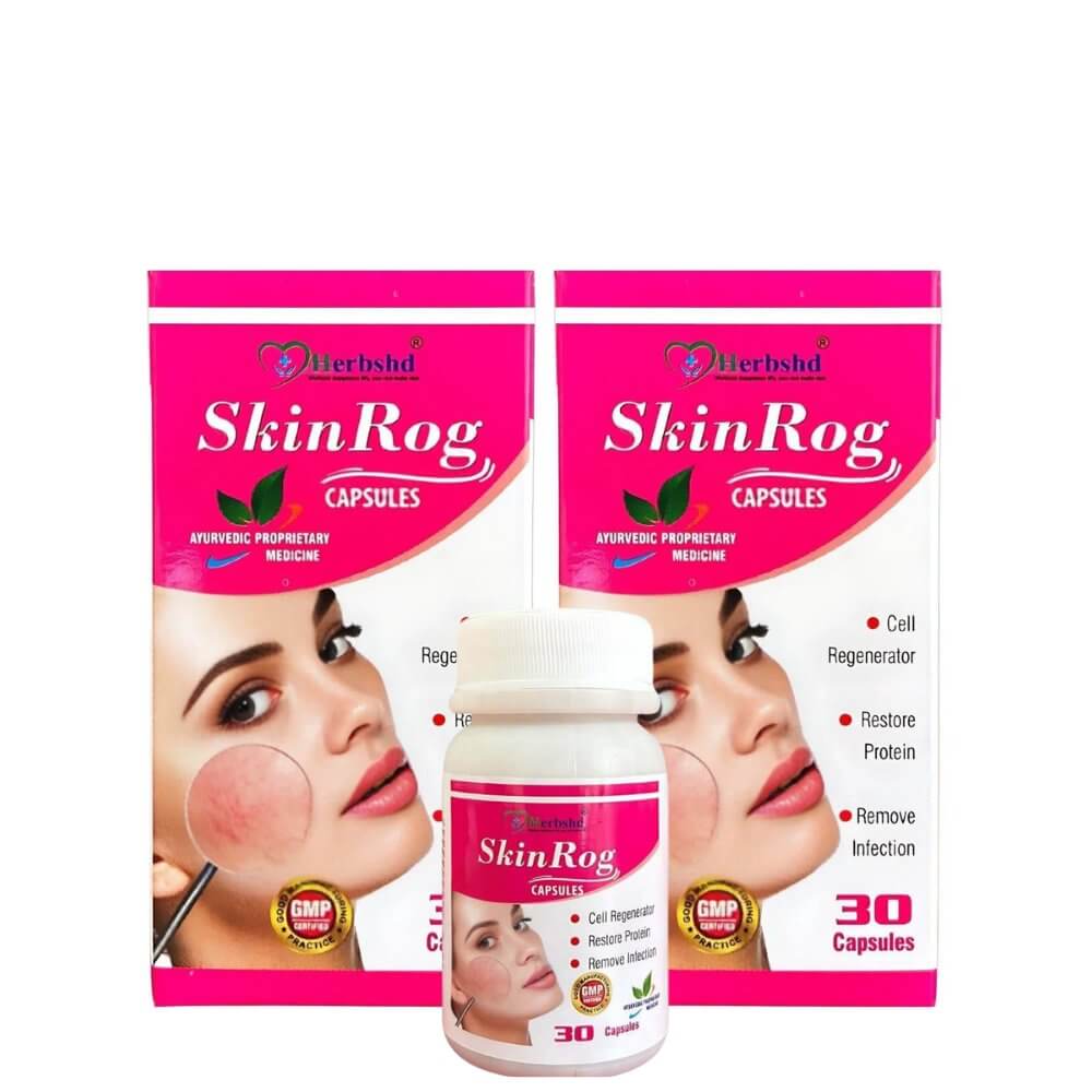 Ayurvedic Skinrog Capsule for Healthy Skin - HEALTH AIM PHARMACY