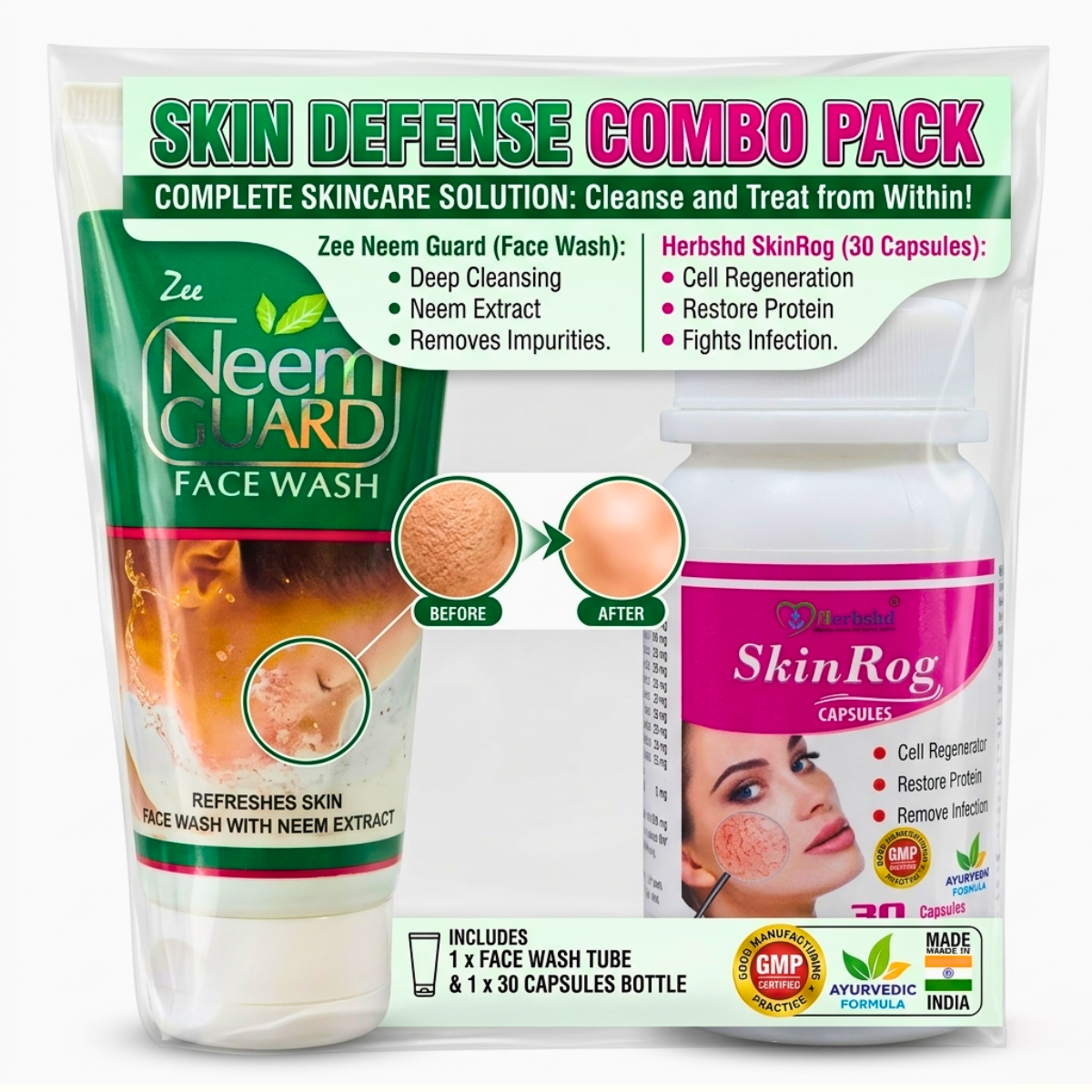 Ayurvedic SkinRog Capsule + Neem Gurd Face Wash | 30Caps + 60Gm | Combo pack of 2 - HEALTH AIM PHARMACY