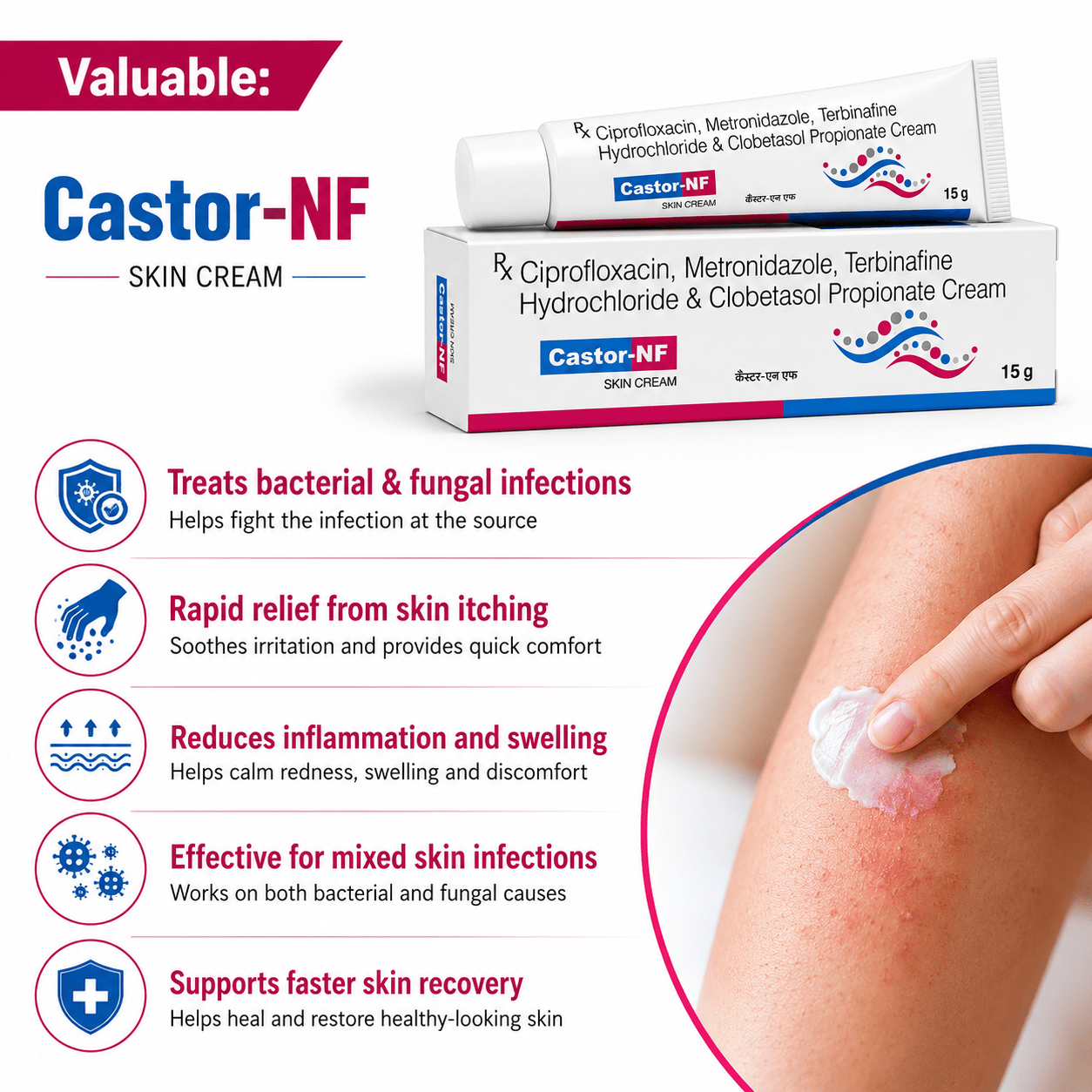 Castor-NF Cream 15g (Pack Of 6) - HEALTH AIM PHARMACY